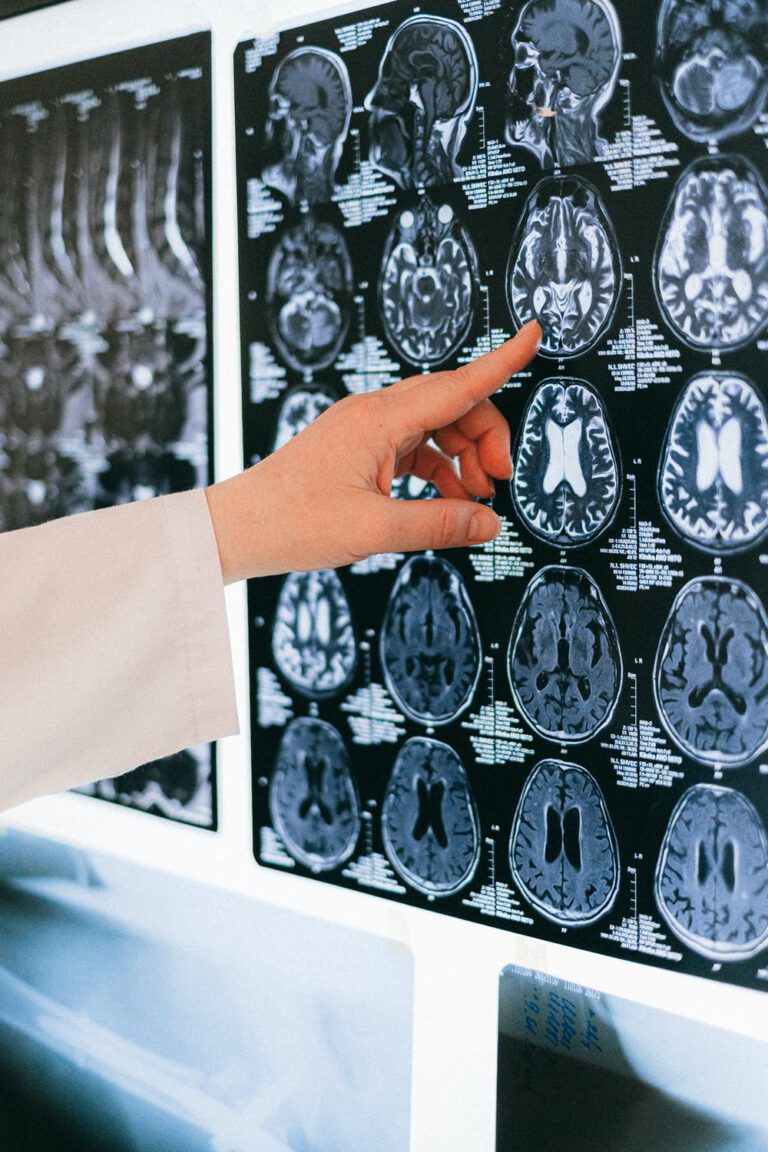 Specialisté na mozek představili devět opatření proti demenci